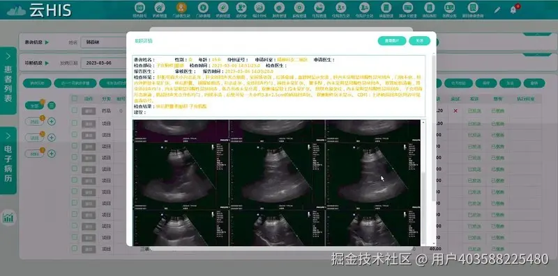 Java版云HIS系统源码，4级电子病历系统