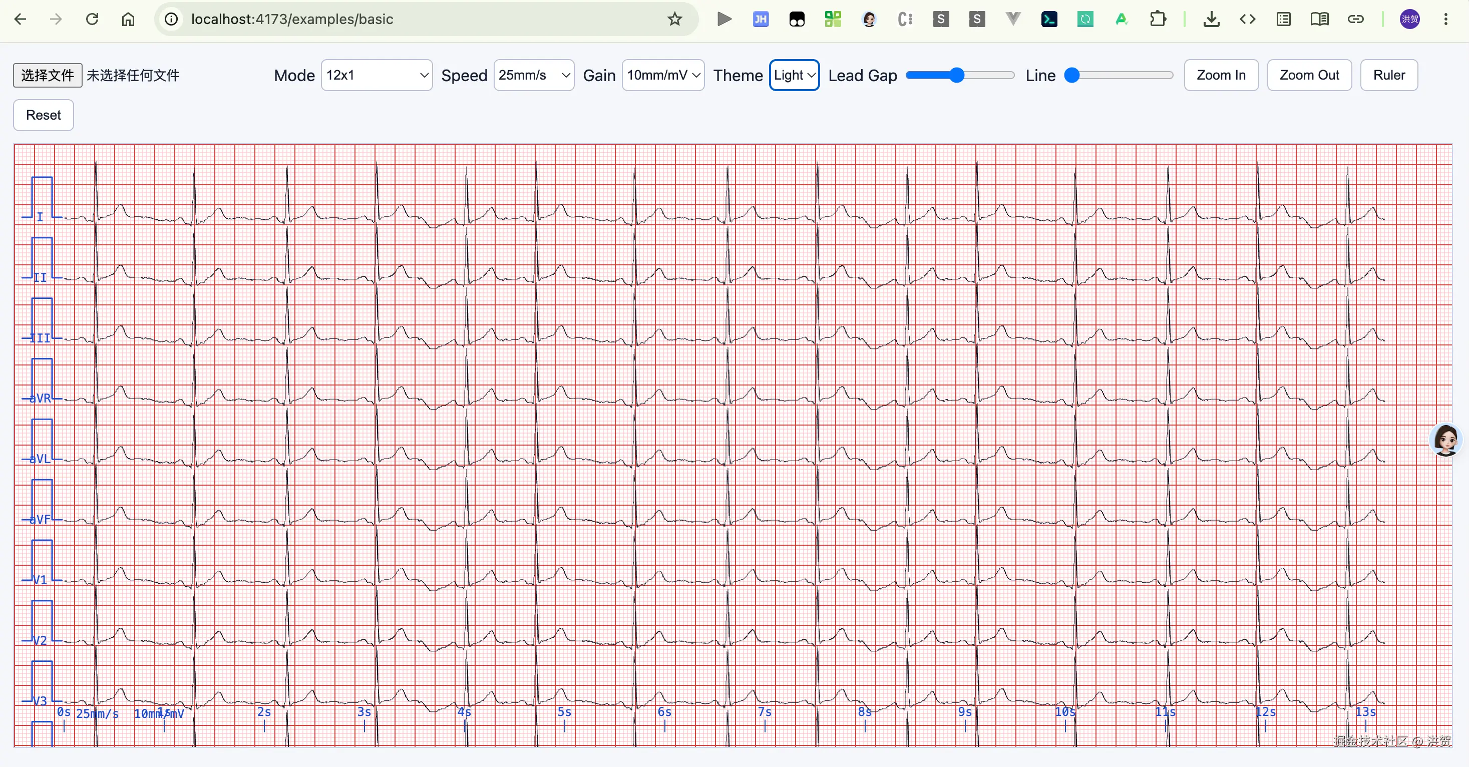 从原始采样到可缩放心电图：用 h5ECG 绘制自己的 ECG