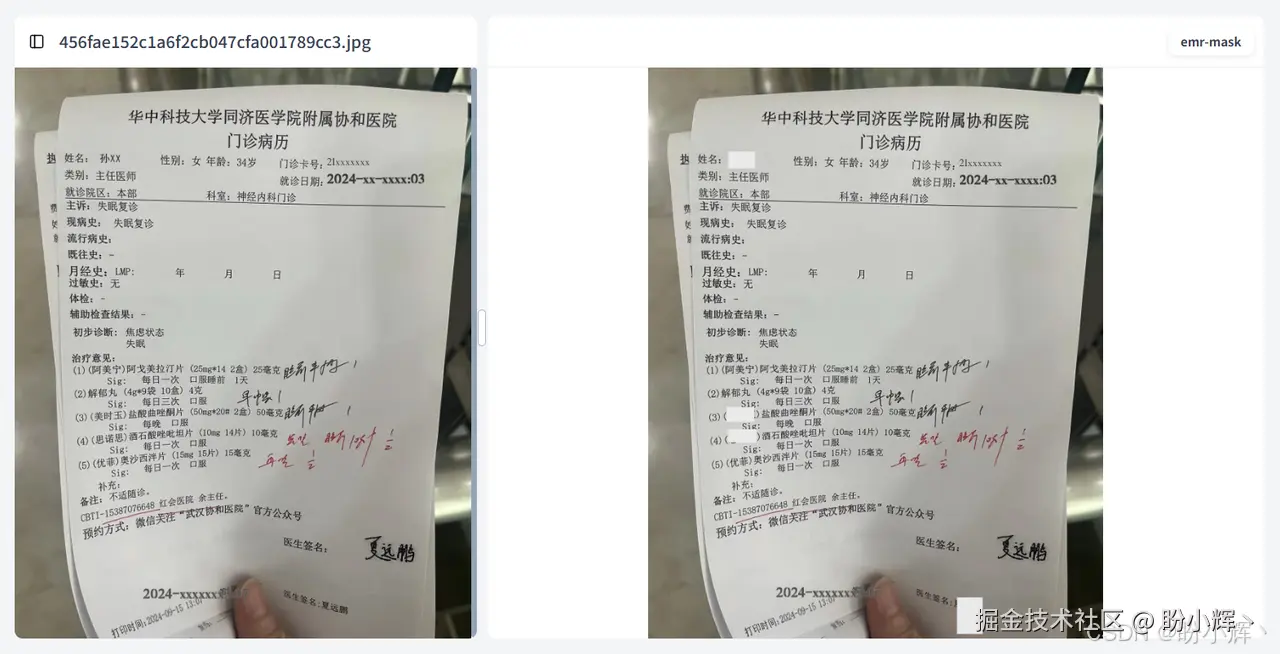 病历脱敏