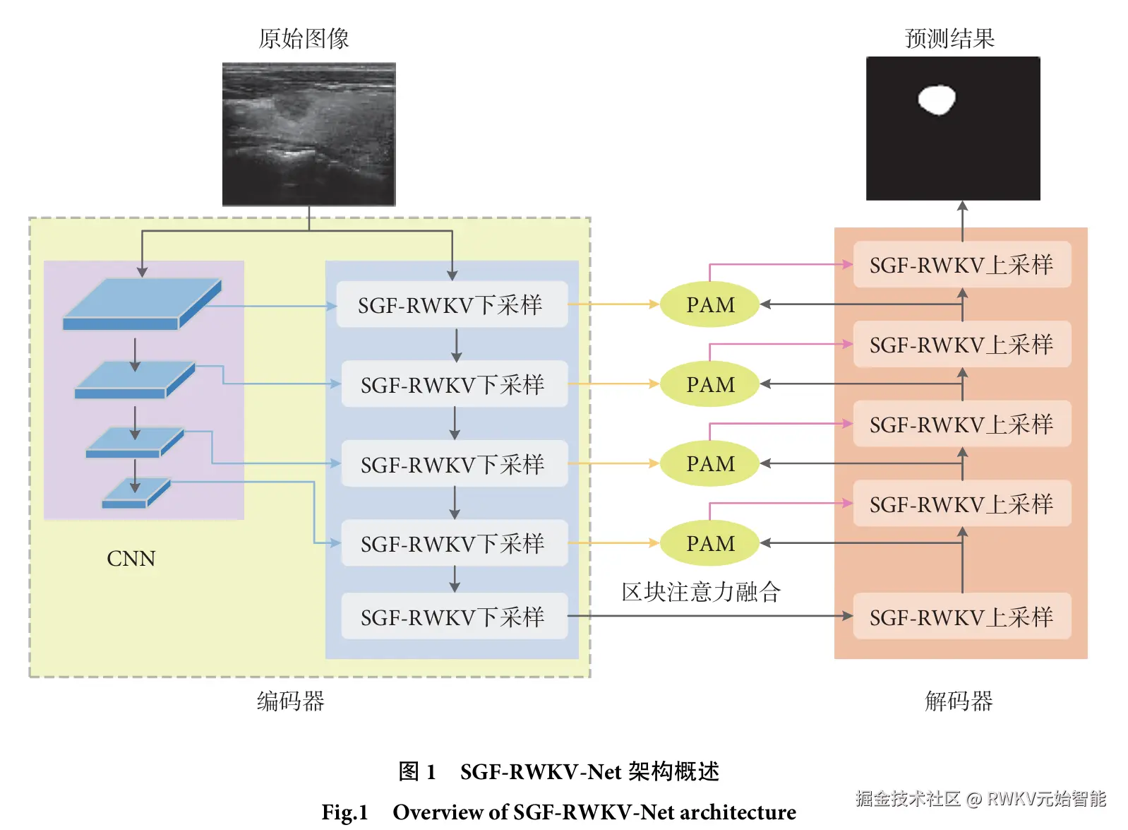 20250529-融合接收加权键值架构和球面几何特征的甲状腺结节分割方法