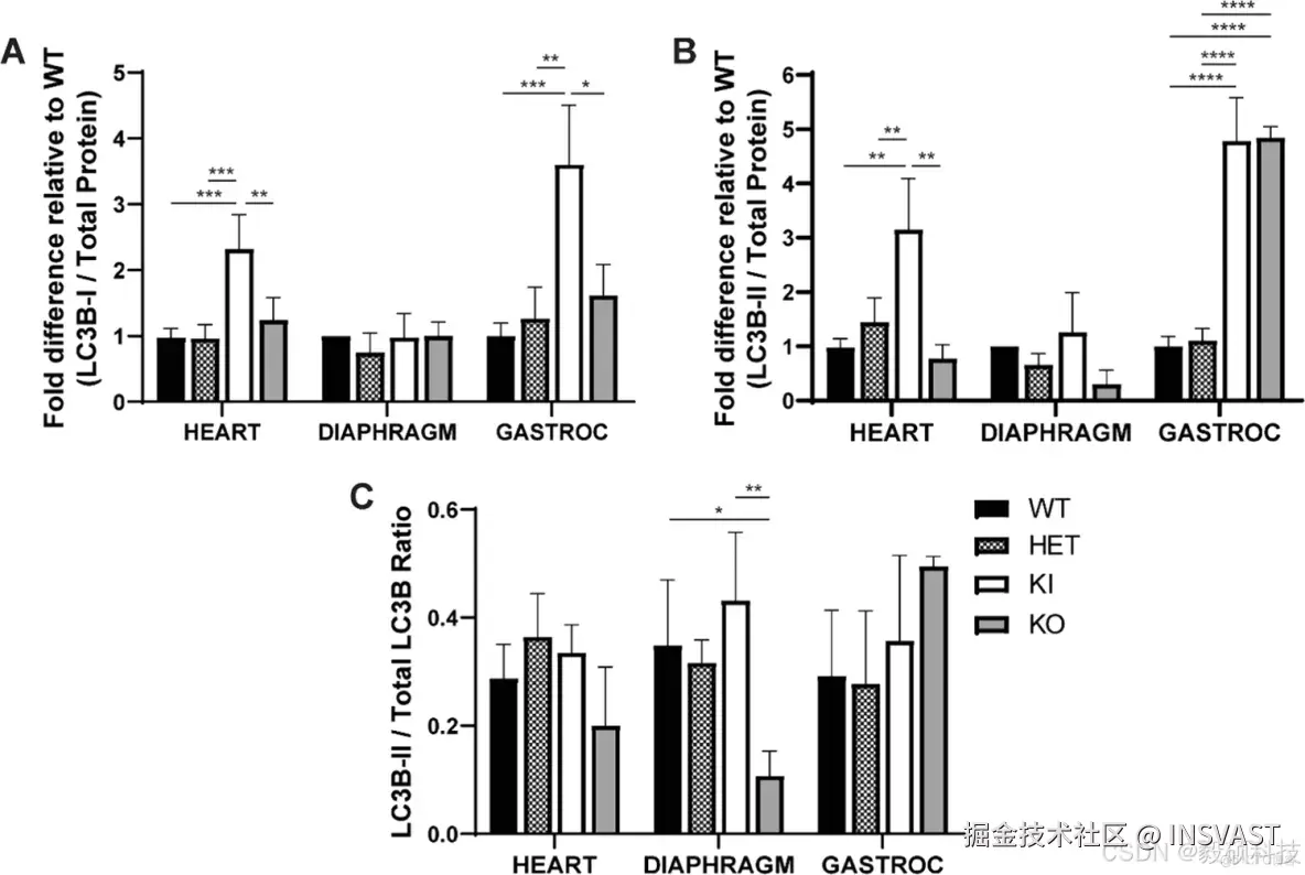 文献解读-CRISPR-Cas9 generated Pompe knock-in murine model exhibits early-onset hypertrophic cardiomyopa_IOPD_07