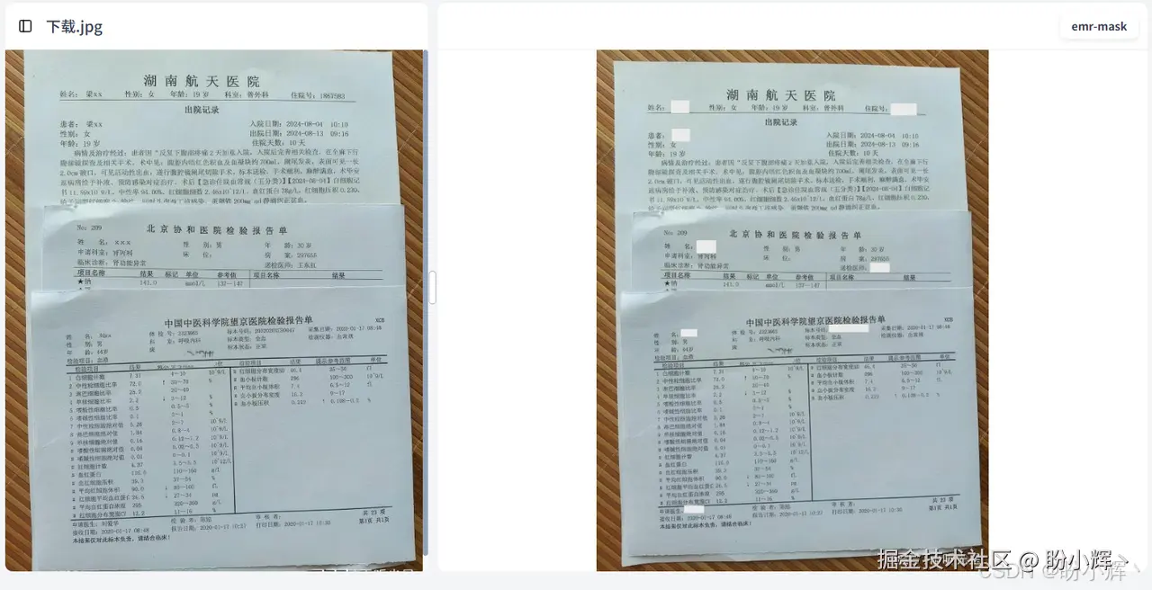 病历脱敏