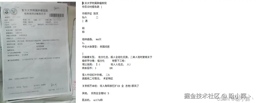 传统OCR