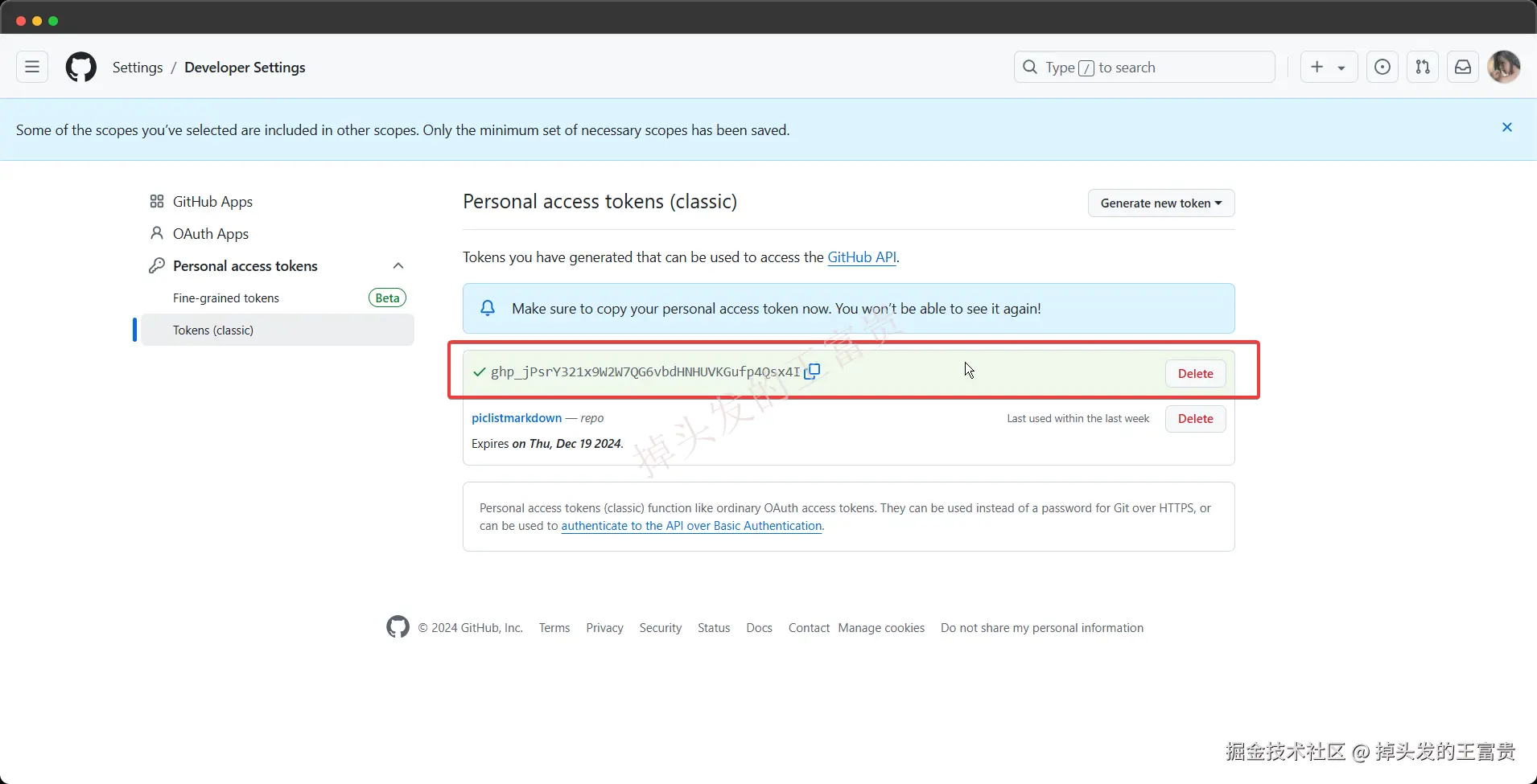 image-20241009195610938