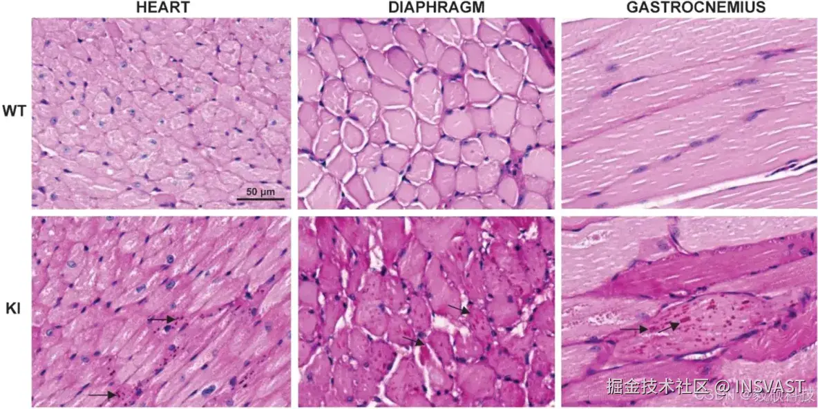 文献解读-CRISPR-Cas9 generated Pompe knock-in murine model exhibits early-onset hypertrophic cardiomyopa_生信分析服务_09