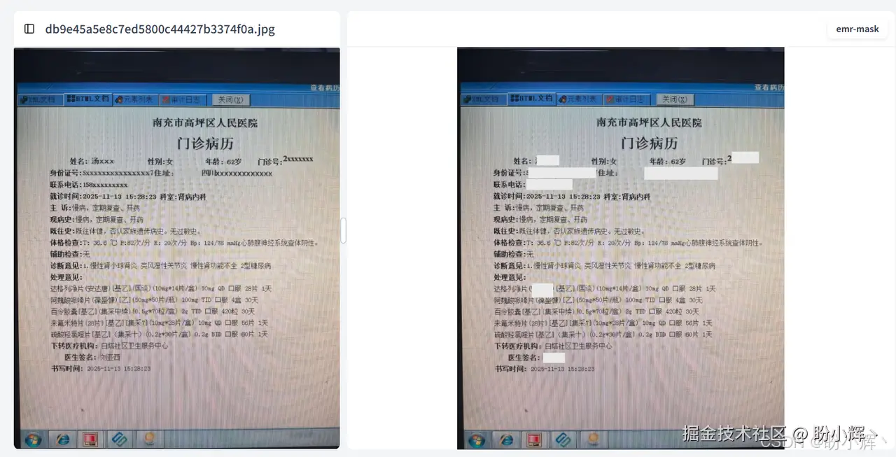病历脱敏