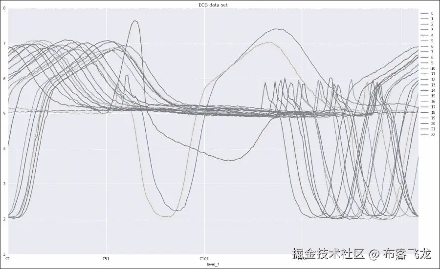 心电图脉冲检测
