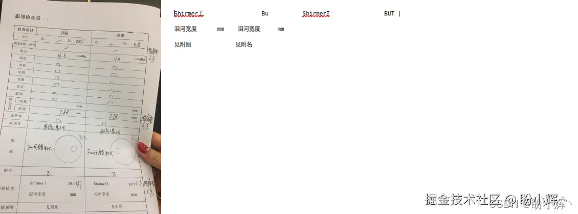 传统OCR
